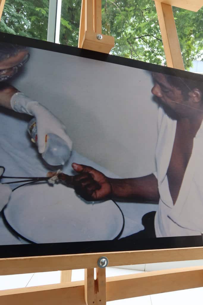 Goiânia - Césio 137